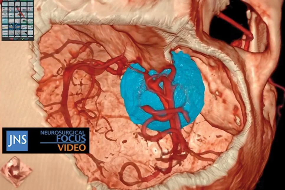 Scholarly Video: a Case Study