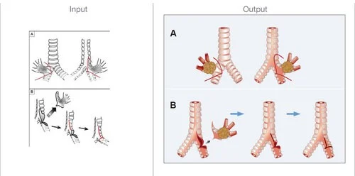 Journal Art Design Bronchi