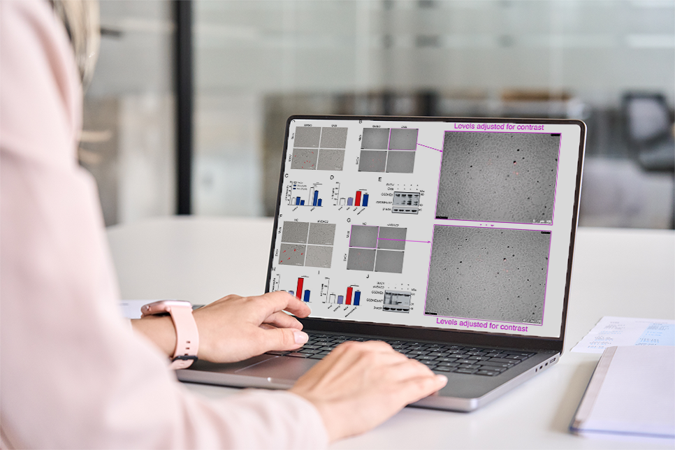 Kgl Image Forensics